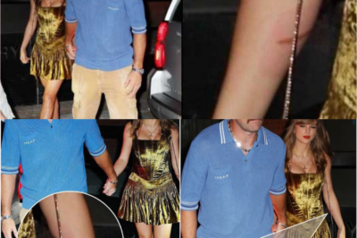 Fans recently spotted Taylor Swift’s noticeable burn in photos with Travis Kelce, which appeared after the night… see more: