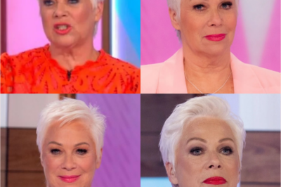 Denise Welch, a popular TV personality from Loose Women, is reaching out for assistance as she shares alarming images of her skin peeling and covered in sores, requiring frequent injections.