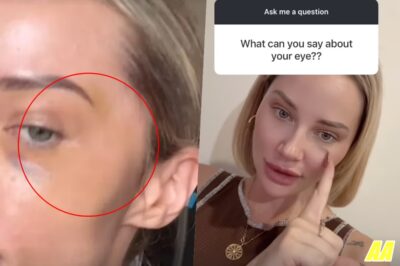 What Really Happened? MAFS Star Jessika Power’s Explosive Breakup and Mystery Black Eye Explained!